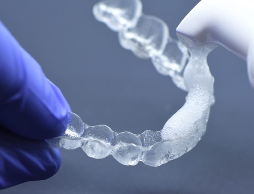 Cum cureți gutierele dentare corect